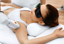 Laser Hair Removal Treatment
