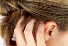 Smoking and Psoriasis